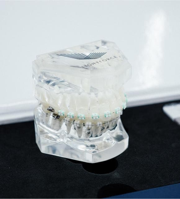 TG Orthodontics Introduces Lightforce Braces, Revolutionizing Orthodontic Care in Texas